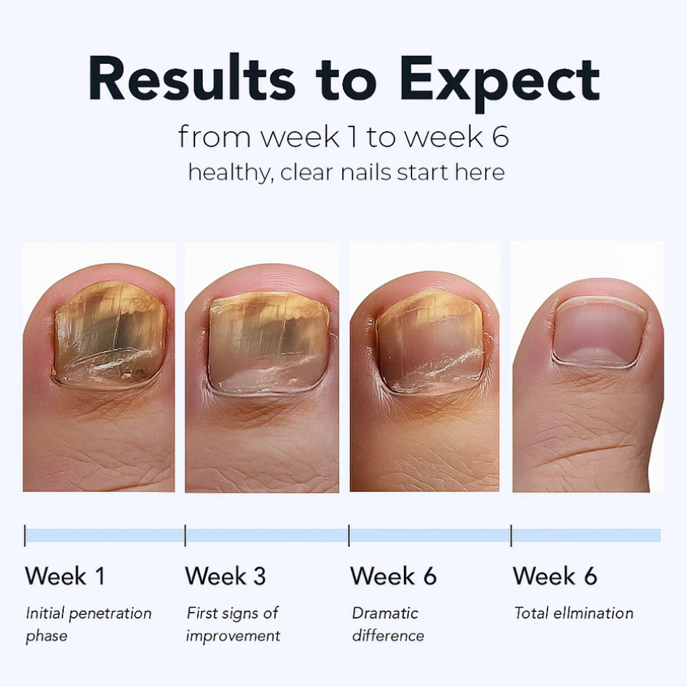 Maanufo - Fungal Nail Renewal Patches