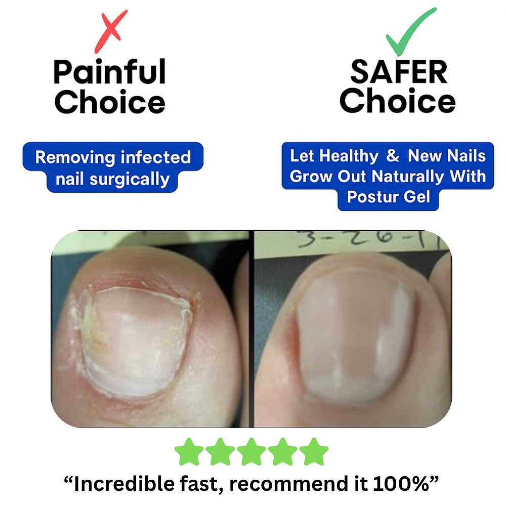 Maanufo - Fungal Nail Renewal Patches